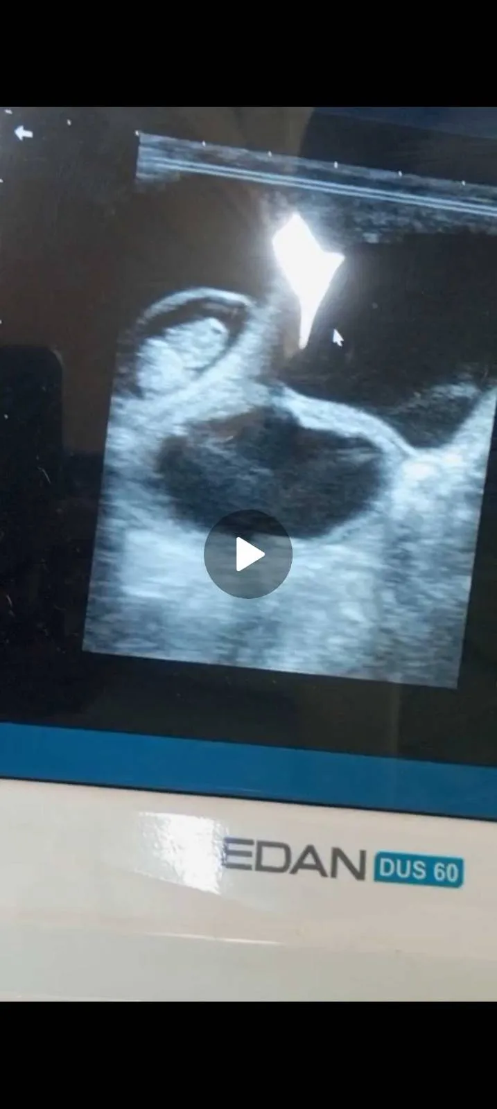 Ultrasound Service